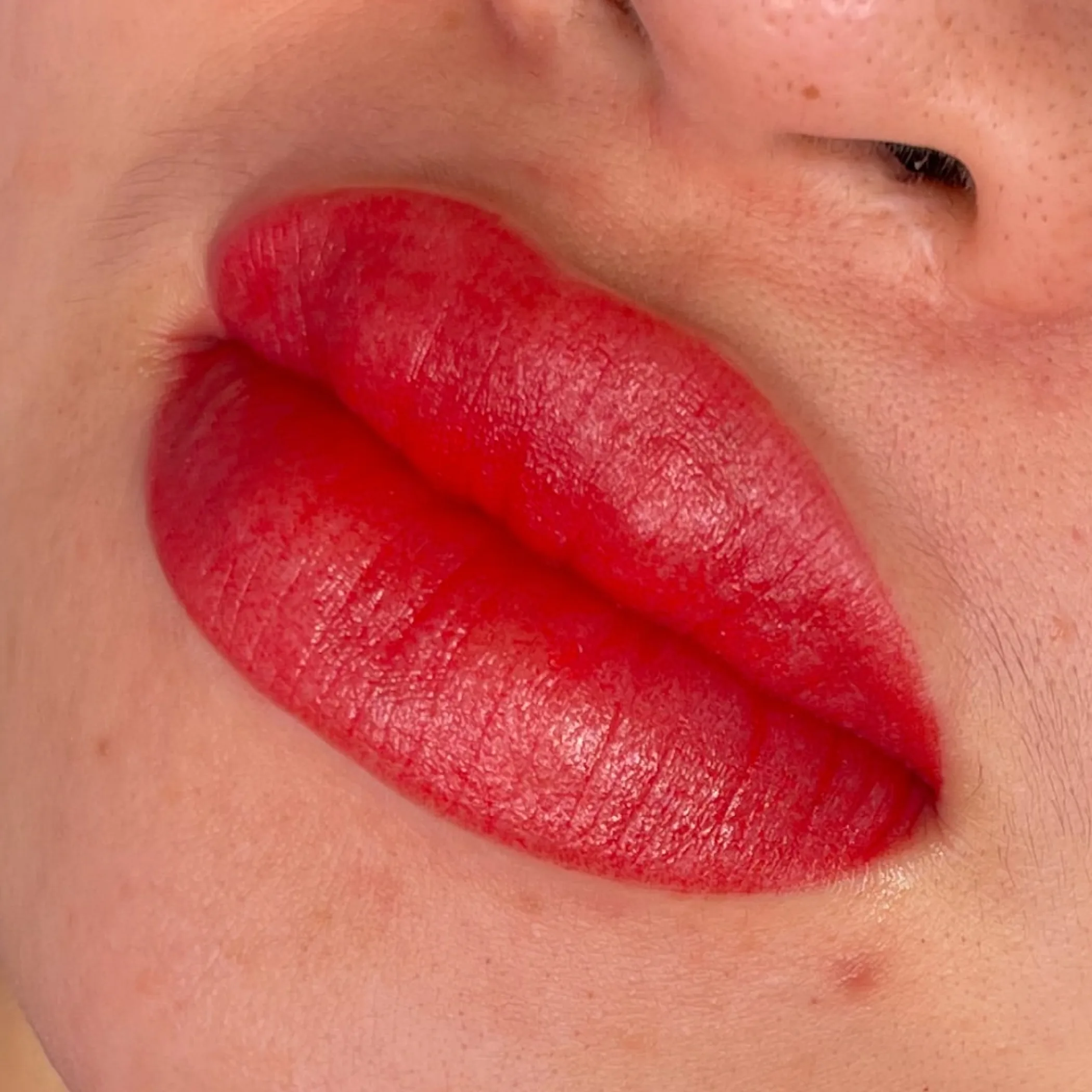 cosmetic lip pigmentation procedure